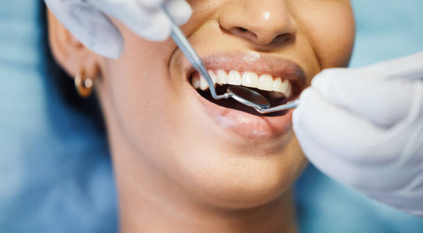 Best Emergency Tooth Extraction in Flemington, GA