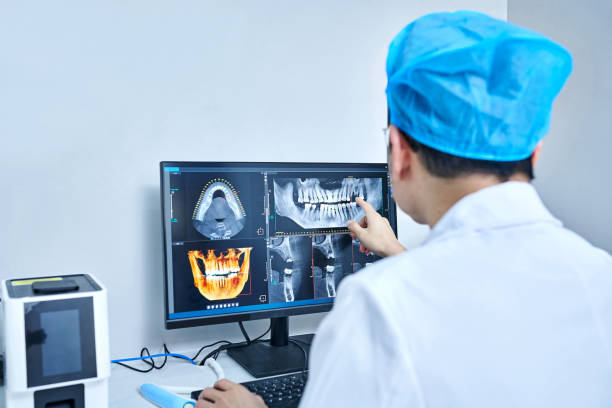 Best Emergency Wisdom Teeth Removal in Flemington, GA